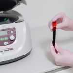 Mãos enluvadas seguram um tubo de amostra de sangue ao lado de uma centrífuga em ambiente laboratorial.