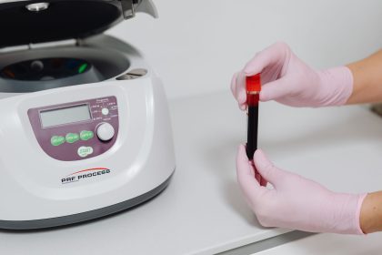 Mãos enluvadas seguram um tubo de amostra de sangue ao lado de uma centrífuga em ambiente laboratorial.