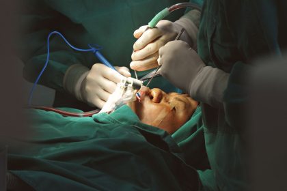 Equipe médica realiza uma cirurgia facial delicada em ambiente hospitalar, com instrumentos cirúrgicos de precisão.