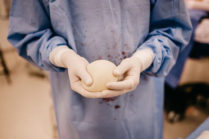 Cirurgião segura um implante mamário de silicone preparado para uma cirurgia.